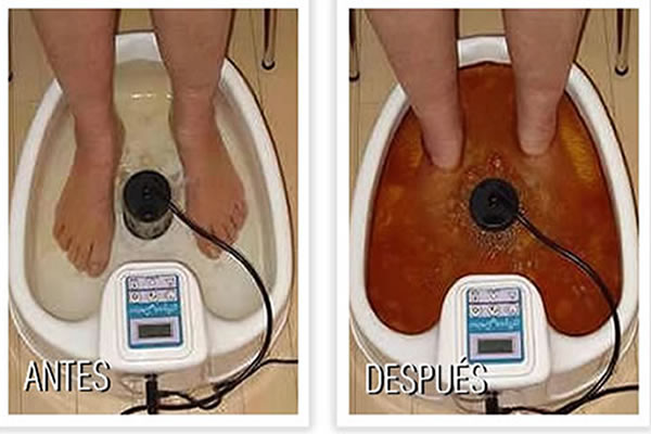 desintoxicacion ionica 600 400